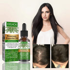Rosemary Anti-Breakage Nourishing Hair Care Oil