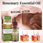 Rosemary Anti-Breakage Nourishing Hair Care Oil